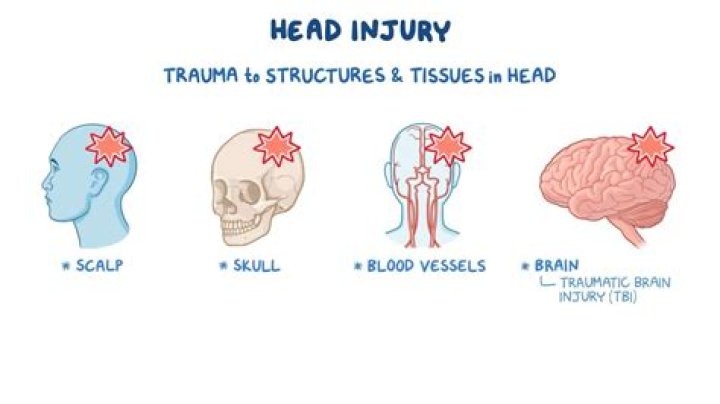 A Comprehensive Guide To Boxing Back Of The Head Injuries