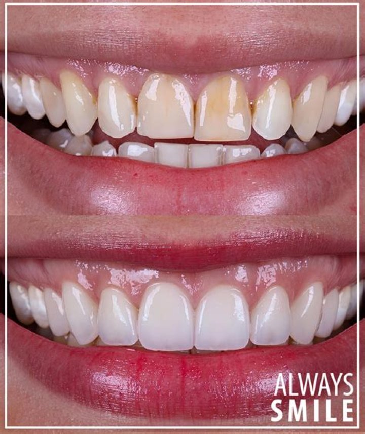 A Journey To A Perfect Smile
