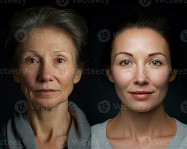 Before And After Photo ·