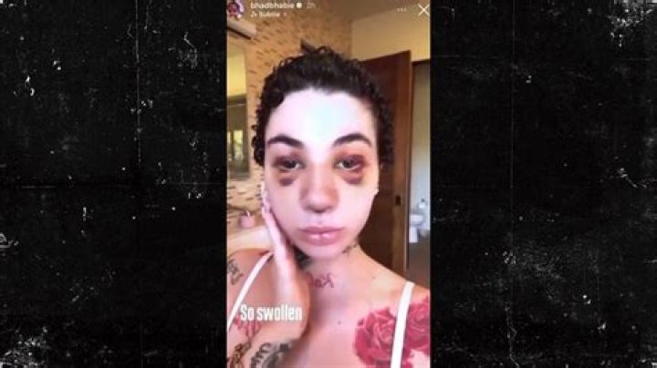Bhad Bhabie Leaked Video Gone Viral: What Is The Story?