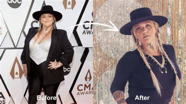 Did Elle King Get Plastic Surgery? Has Elle King Lost Weight?