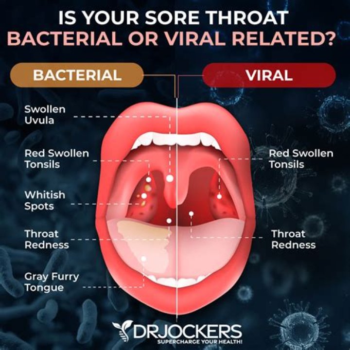 Does Sprite Hold The Cure For Sore Throats?