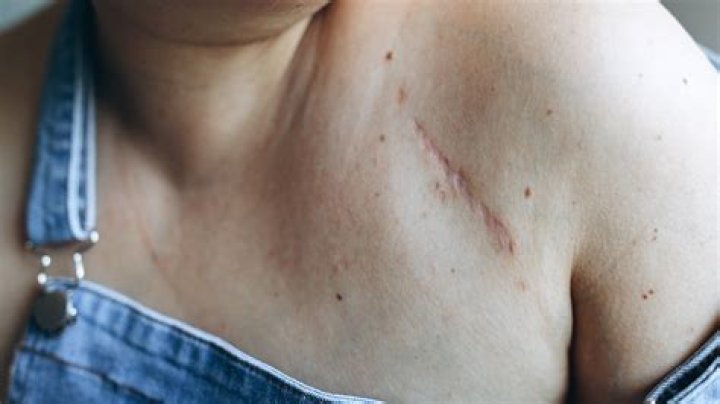 Is Bruce Willis shoulder scar real? Celebrity.fm #1 Official Stars, Business & People Networ