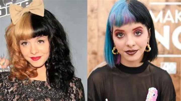 Melanie Martinez Before Surgery: Unveiling The Hidden Truths