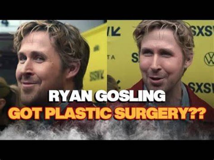 Ryan Gosling Plastic Surgery: Surprising Revelations Unveiled