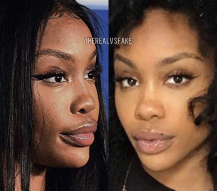 SZA's Plastic Surgery Journey Explored