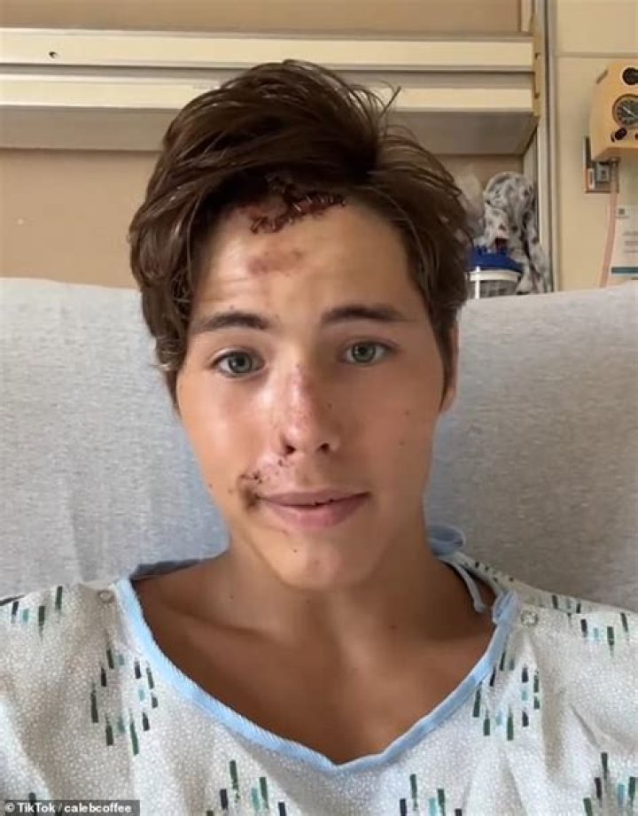 Uncover Hope And Resilience: Caleb Coffee's GoFundMe Journey