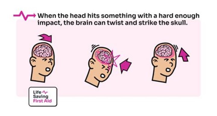 Uncover The Perils And Protections Of "Hit In The Back Of The Head Boxing"