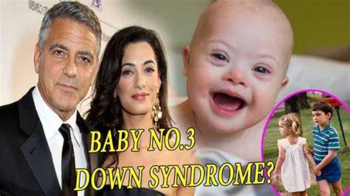 Unraveling The Truth: George Clooney's Twins And Down Syndrome