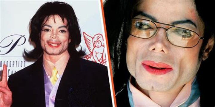 Unveiling Michael Jackson's Transformation: Exploring "Avant Chirurgie"