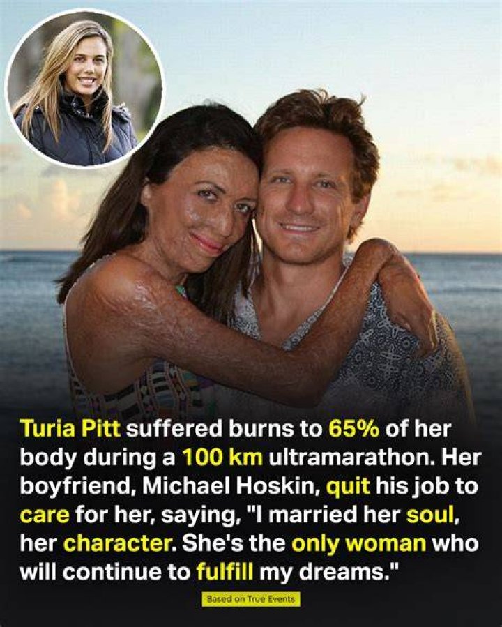 Who Is Turia Pitt Husband Michael Hoskin? Everything To Know About Him