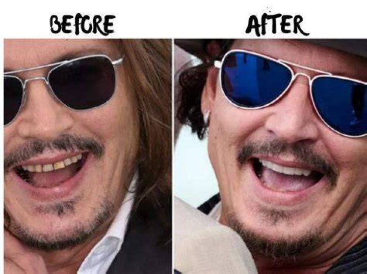 Why Does Johnny Knoxville Always Wear Sunglasses? Everything About His Illness And More